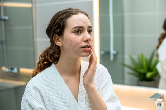 Une jeune femme en peignoir blanc examine son acné sur le côté du visage