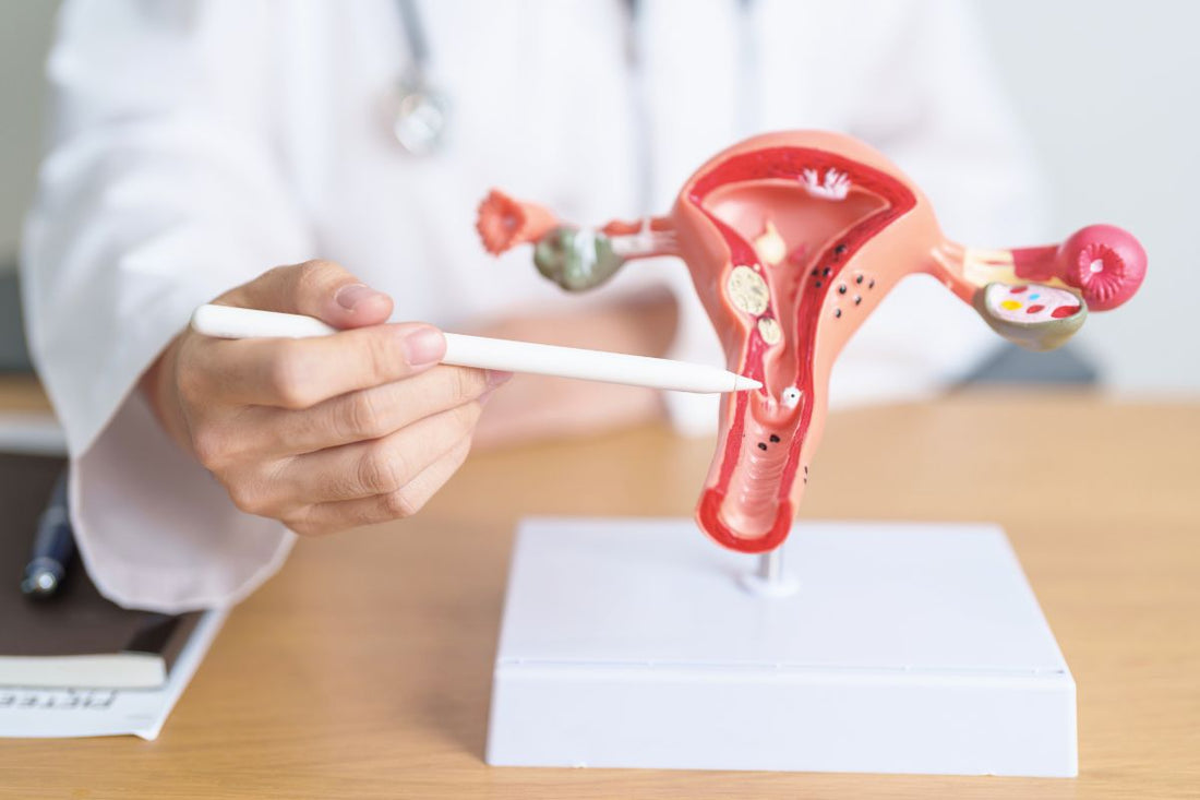 Un médecin pointe un modèle anatomique de l'utérus et des ovaires pour expliquer le SOPK